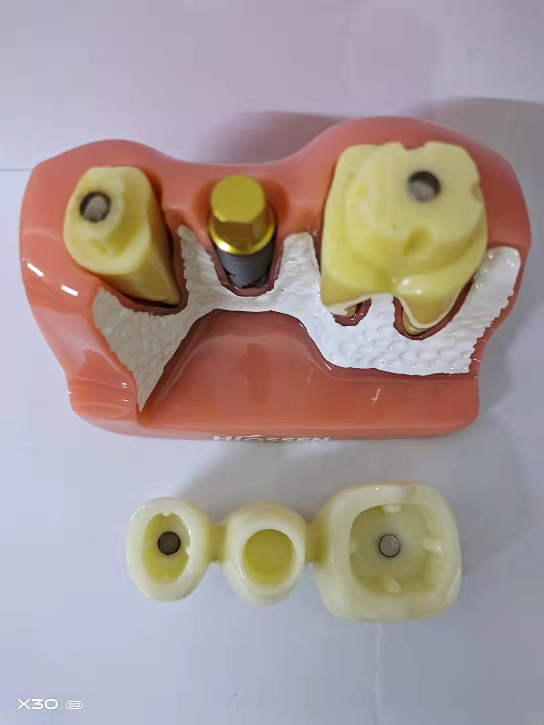 DENTAL IMPLANT MODEL 4 TIMES